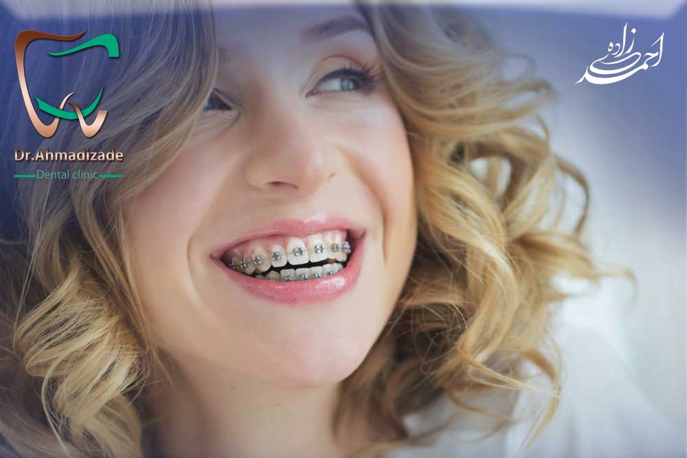 ارتونسی در قیطریه