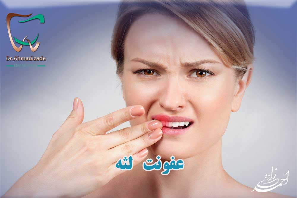 عفونت لثه و عفونت دهان و دندان