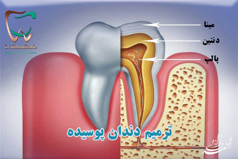 ترمیم دندان