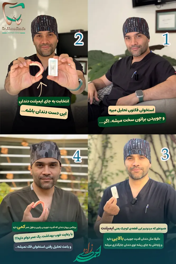 اینفوگرافی ایمپلنت یا دست دندان