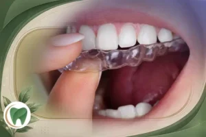 ارتودنسی بدون سیم