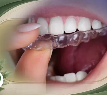 ارتودنسی بدون سیم