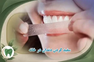 سفید کردن دندان در خانه
