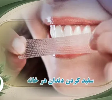 سفید کردن دندان در خانه
