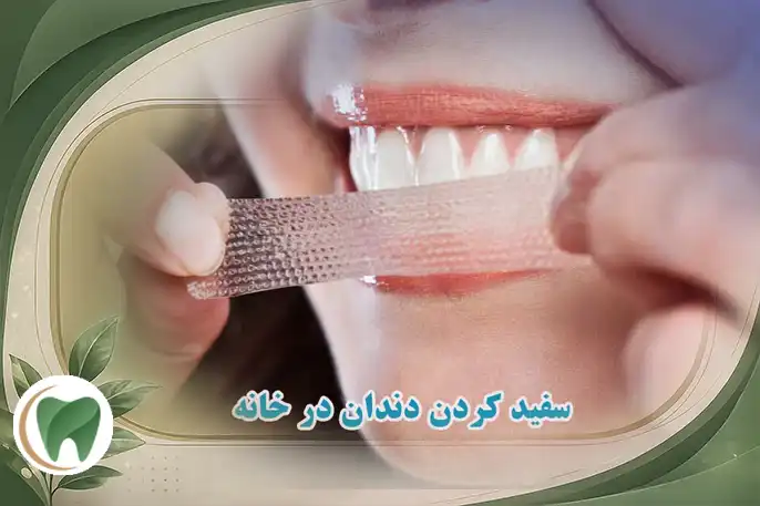 سفید کردن دندان در خانه