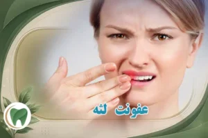 عفونت لثه و عفونت دهان و دندان