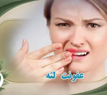 عفونت لثه و عفونت دهان و دندان