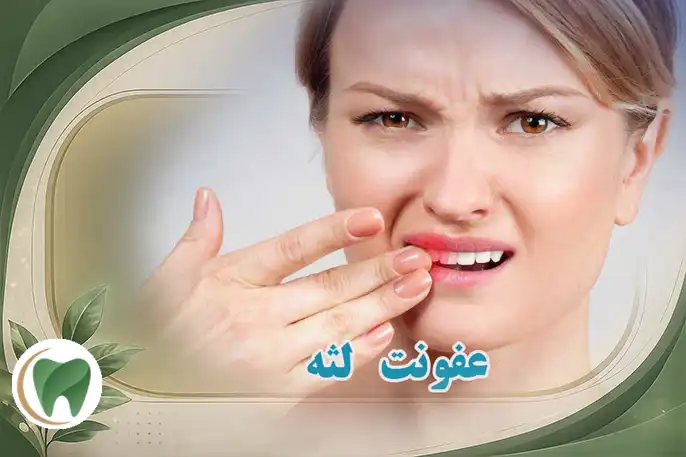 عفونت لثه و عفونت دهان و دندان