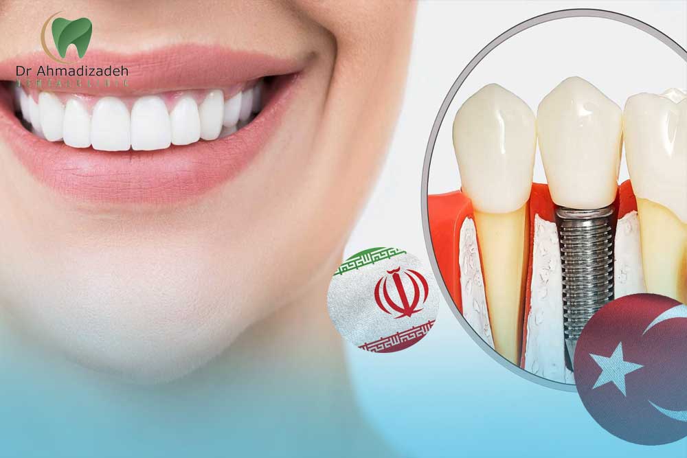 مرکز ایمپلنت ایرانیان استانبول ترکیه 