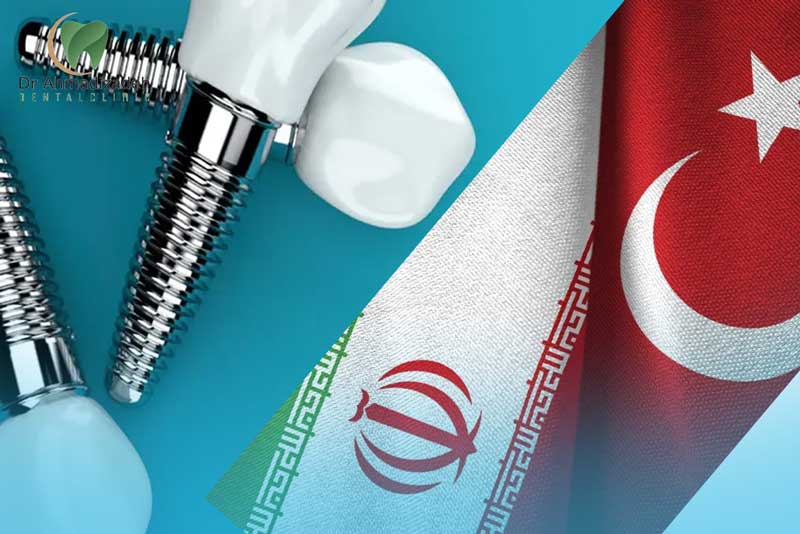 ایمپلنت ترکیه2