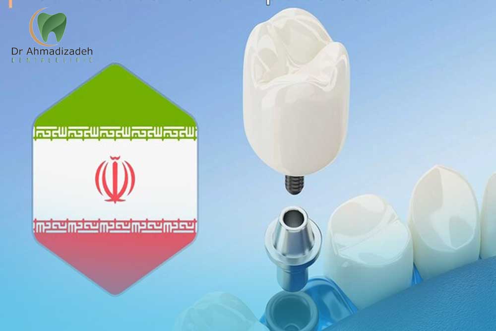 Dental Implant Cost in Iran