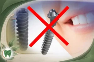 این افراد نمی توانند ایمپلنت کنند