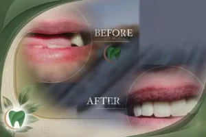 Affordable and High-Quality Treatment in Tehran