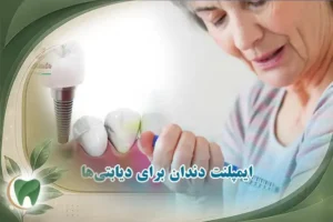 ایمپلنت دندان برای دیابتی‌ها