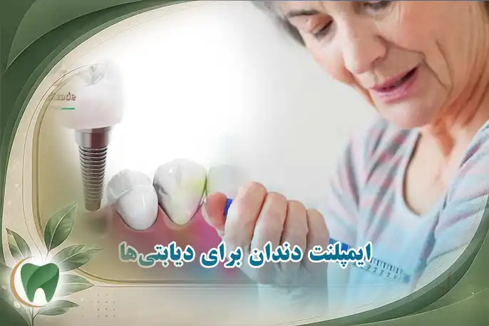 ایمپلنت دندان برای دیابتی‌ها