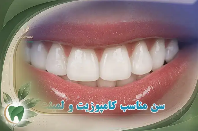 سن مناسب برای کامپوزیت
