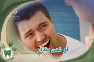لق شدن دندان چه دلایلی دارد