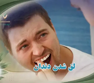 لق شدن دندان چه دلایلی دارد