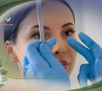 مراقبت های بعد از جراحی سینوس لیفت