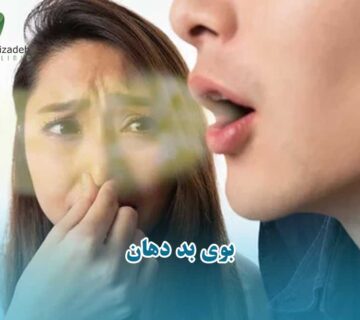 بوی بد دهان
