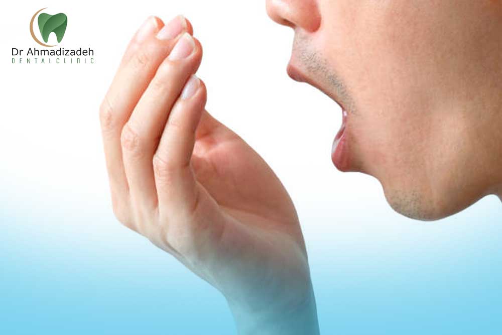 بوی بد دهان