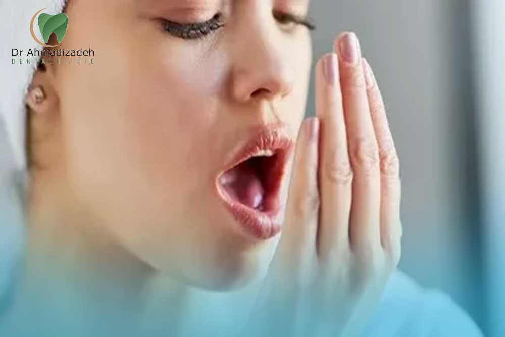 بوی بد دهان