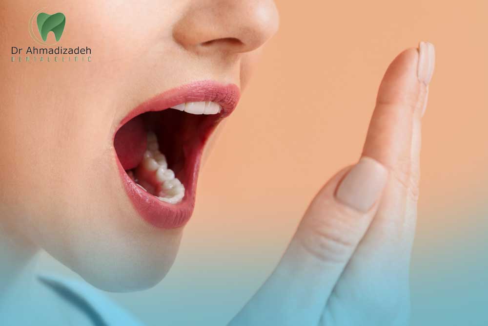 بوی بد دهان از کجاست