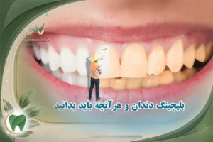 هزینه بلیچینگ دندان