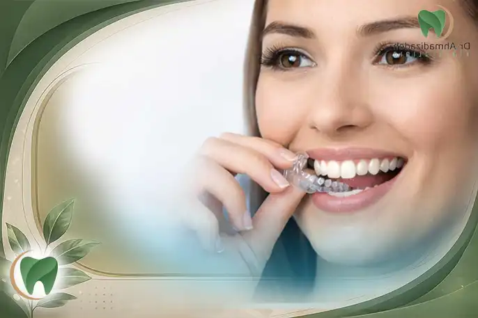 ارتودنسی الاینر