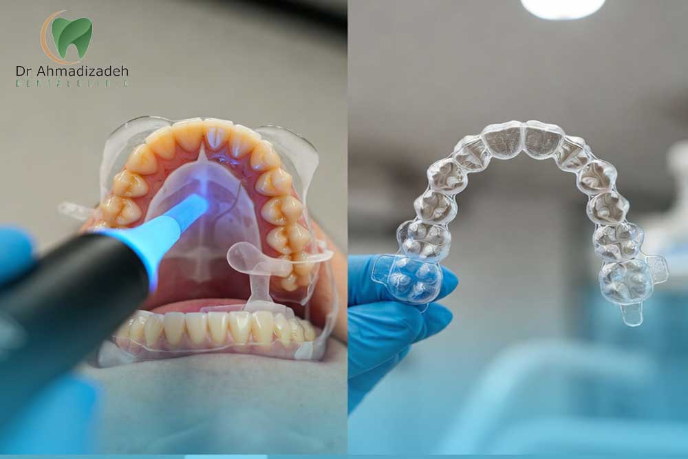 ارتودنسی الاینر