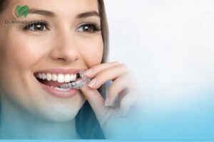 ارتودنسی الاینر