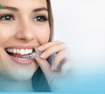 ارتودنسی الاینر