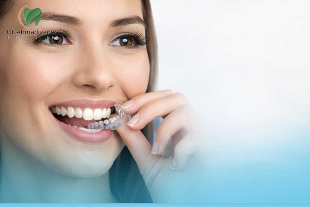 ارتودنسی الاینر