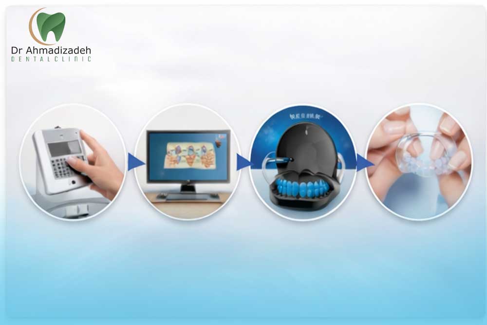 ارتودنسی الاینر