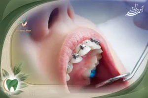 ارتودنسی دندان در قیطریه