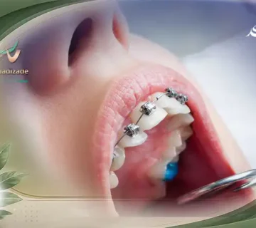 ارتودنسی دندان در قیطریه