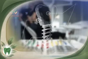ایمپلنت دیجیتال چیست