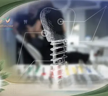 ایمپلنت دیجیتال چیست