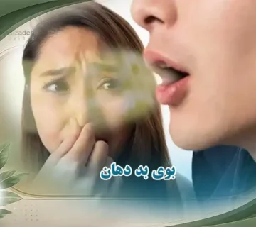 بوی بد دهان