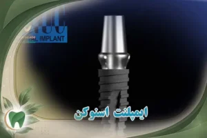 قیمت ایمپلنت اسنو snucone 