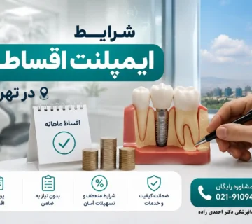 ایمپلنت قسطی در تهران