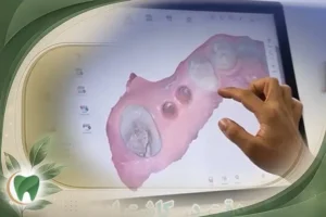 اسکن دیجیتالی دندانپزشکی
