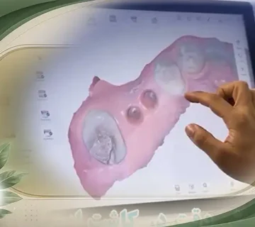 اسکن دیجیتالی دندانپزشکی