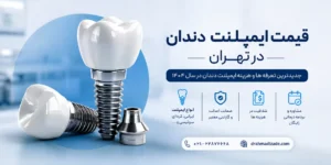 قیمت ایمپلنت دندان در تهران