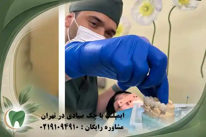 ایمپلنت با چک صیادی در تهران