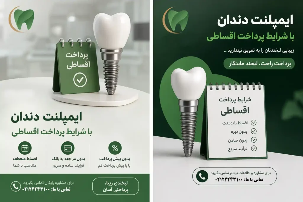 پیش‌پرداخت ایمپلنت چقدر است؟