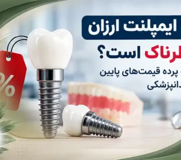 آیا ایمپلنت ارزان خطرناک است