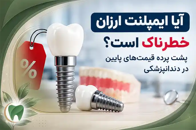 آیا ایمپلنت ارزان خطرناک است