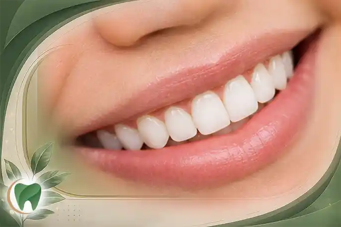قیمت ایمپلنت زیرکونیا