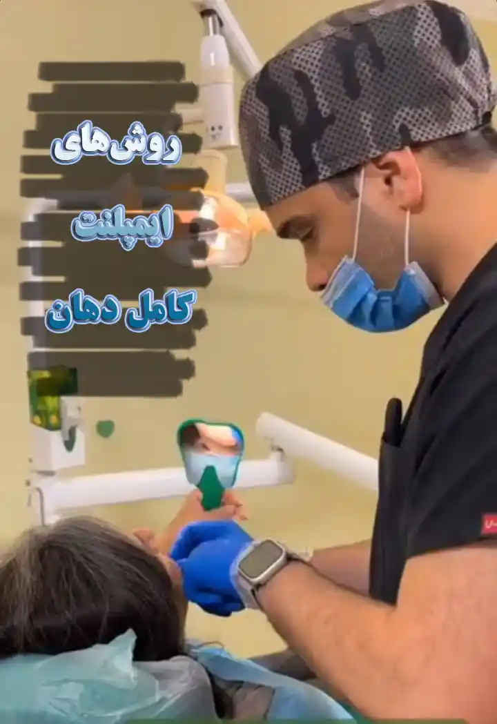 هزینه ایمپلنت کل دهان